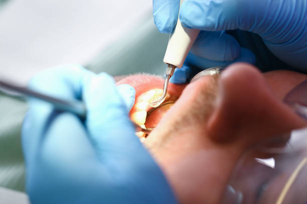 Best Orthodontic Emergency Dentist in Yountville, CA