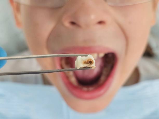 Best Mobile Emergency Dentist in Yountville, CA