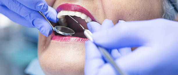 Best Emergency Dental Care for Abscessed Tooth in Yountville, CA